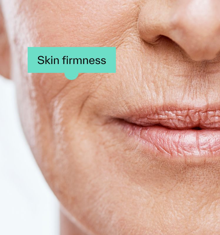 Skin firmness