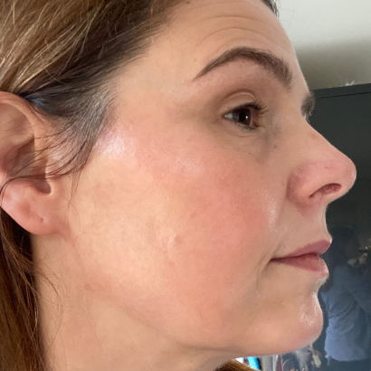 Dermatica - After picture