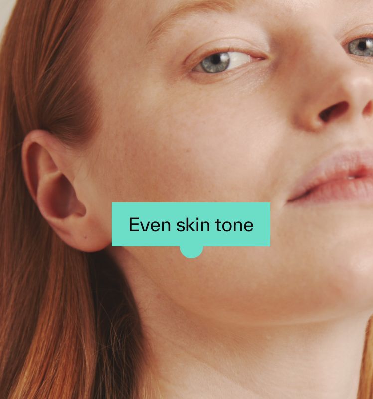 Even skin tone